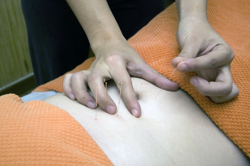 osteopathe-LA FARLEDE-min_acupuncture-4175625